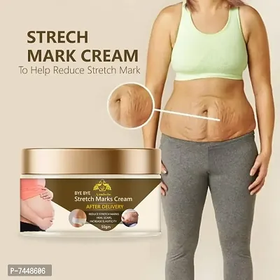 STRETCH MARK CREAM